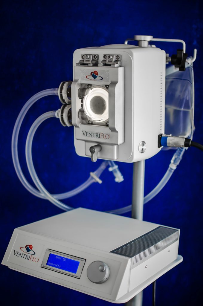 VentriFlo True Pulse Pump